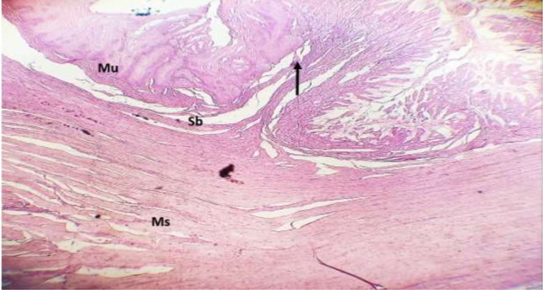 Control group showing  the Four basic layers in esophagus and Gastro - esophageal gate) ( black arrow). H&E stain.10X.