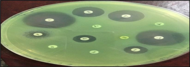Sensitivity test by using discs diffusion assay.