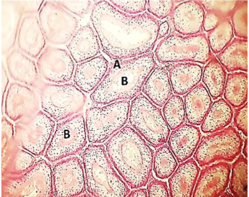 Microscopically  section of the epididymis in Iraqi local rooster  shows: epithelial lining pseudostratified type(A), ductus epididymis contains spermatozoa(B) . PAS stain(40X)