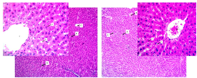 Representative image for liver (left) control, (right) after 3 month stimulation of B3 receptor with Mirabegron. H and E stain, 100X and 400X.