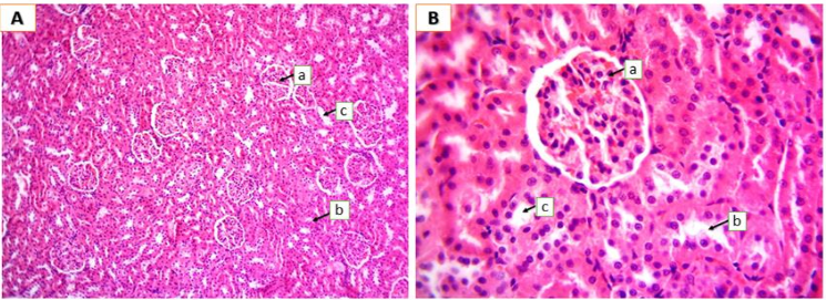 Photomicrographs of renal tissue from the control group.Images showed normal glomeruli (a), proximal renal tubules (b), and distal renal tubules (c) of the rat kidney; A (100X), B (400X). H and E stains.