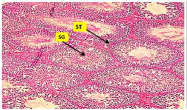 Histological section for testis in control group showed no occupied lesion in the testis section, normal seminiferous tubules (ST), with  normal spermatogenesis (SG).(H&Estain) 10X.