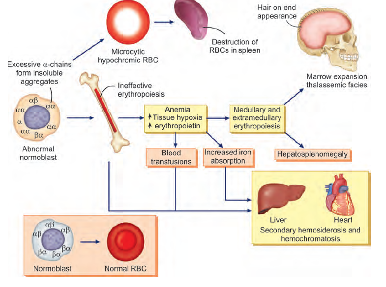 Pathogenesis of β-thalassemia major and its consequences (Nayak and Raj, 2017)